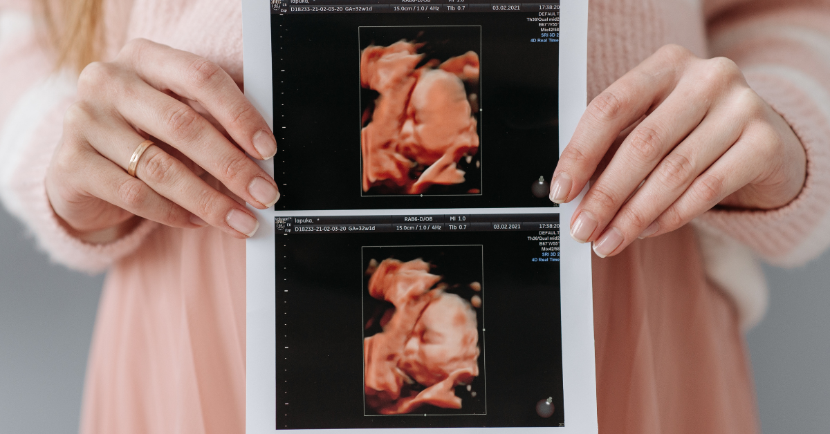 Woman looking hopeful while holding her belly, symbolizing the possibility of pregnancy after my tubes were tied.