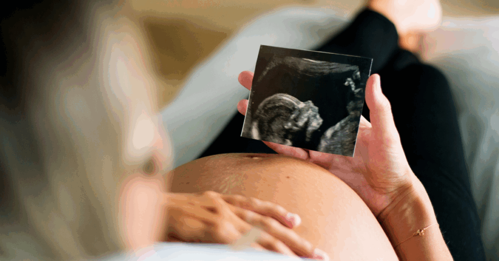 Pregnant woman after natural conception from tubal reversal