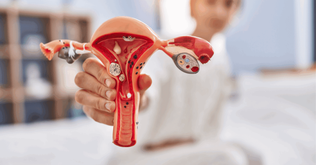 Illustration showing the tubal reversal procedure and restored connection in the fallopian tubes.